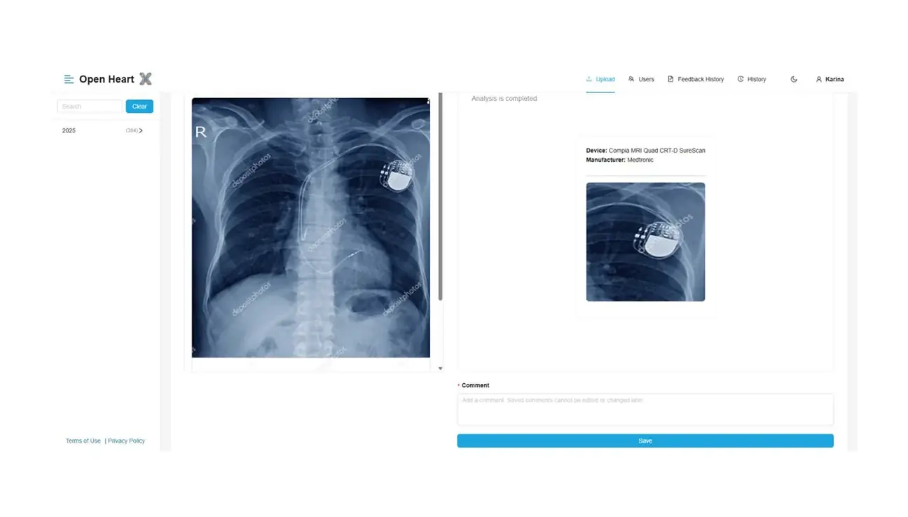 Schmidt Surgery Center: AI рентгенде кардиоқұрылғыларды таниды